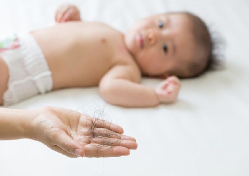 Trẻ sơ sinh 6 tháng đầu đời bị rụng tóc là điều bình thường. Nguồn từ health