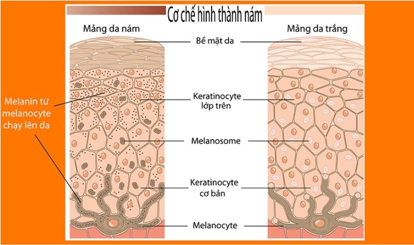 Cơ chế hình thành hắc tố melanin