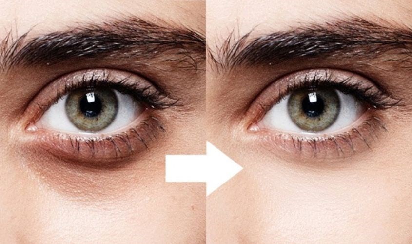 Melanin là thành phần quan trọng quyết định sắc tố màu da