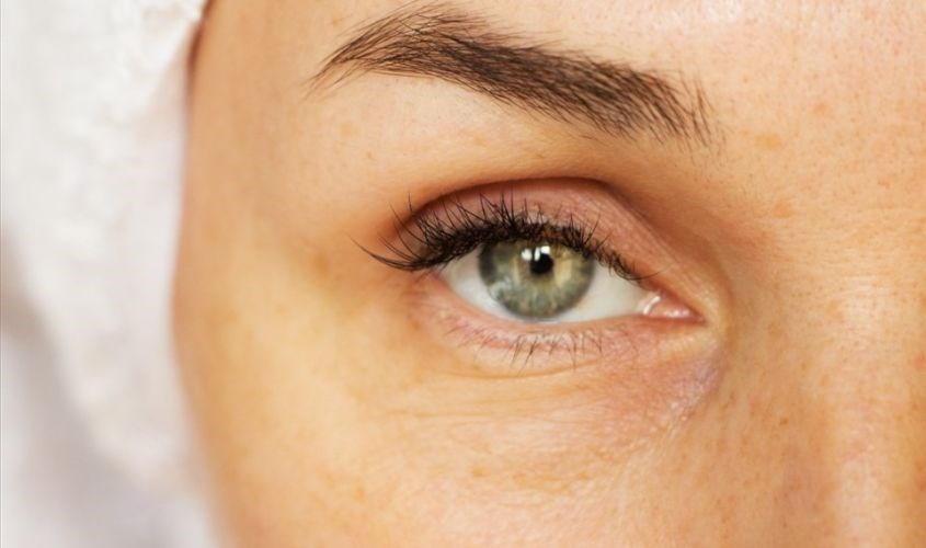 Ngủ đủ giấc và uống đủ nước để giảm tình trạng bọng mắt