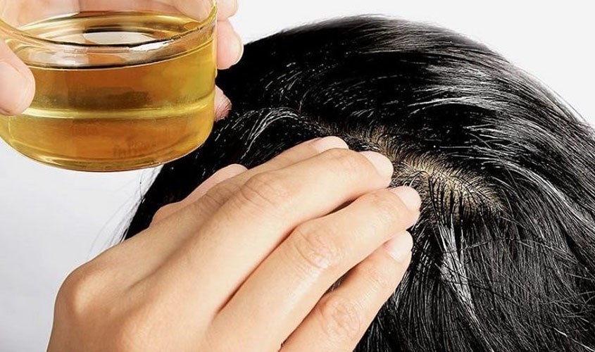 Mật ong giúp cải thiện sức khỏe da đầu Mật ong giúp cải thiện sức khỏe da đầu