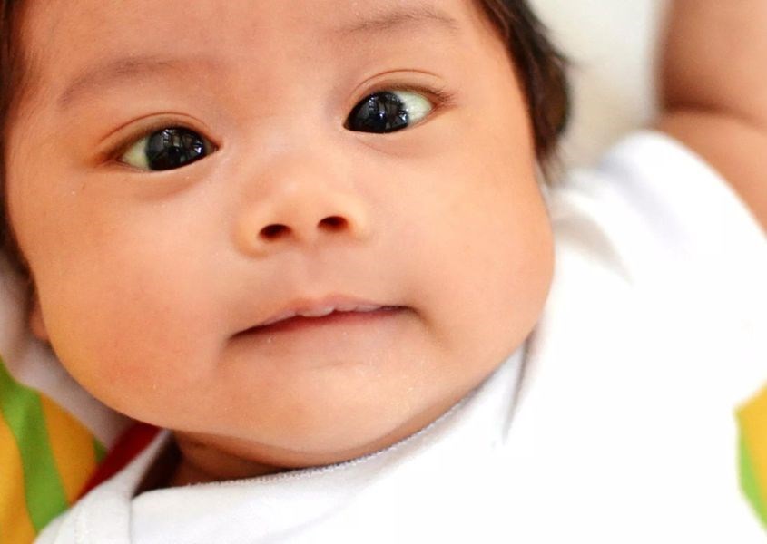 Mắt của trẻ nhỏ bị lác. Nguồn: TheBump.com