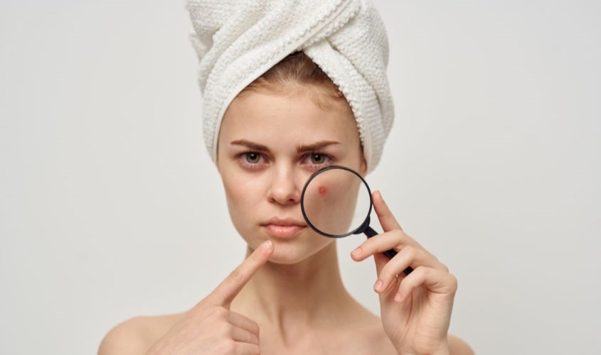 Không nên đắp mặt nạ sữa chua cho da mụn