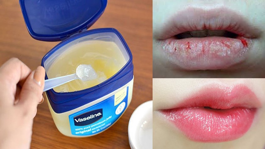 Vaseline giúp làm mềm và tái tạo da môi