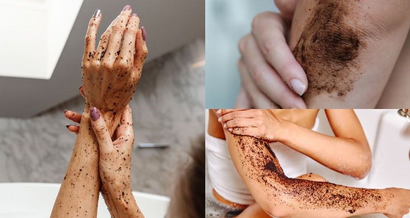 Các vùng trên cánh tay gồm cánh tay, khuỷu tay và bàn tay