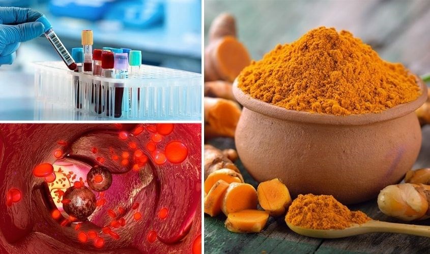 Dược tính có trong nghệ đỏ Dược tính có trong nghệ đỏ