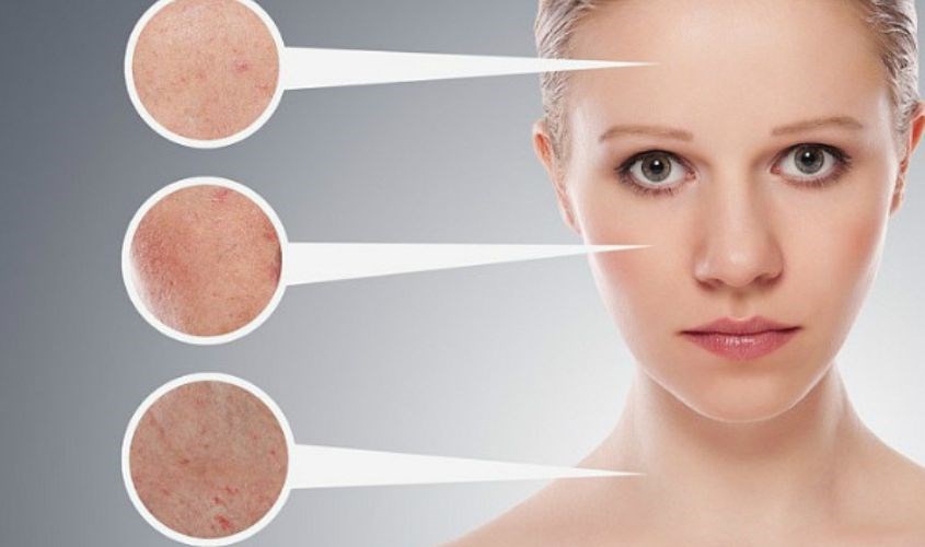 Serum Some By Mi có đẩy mụn