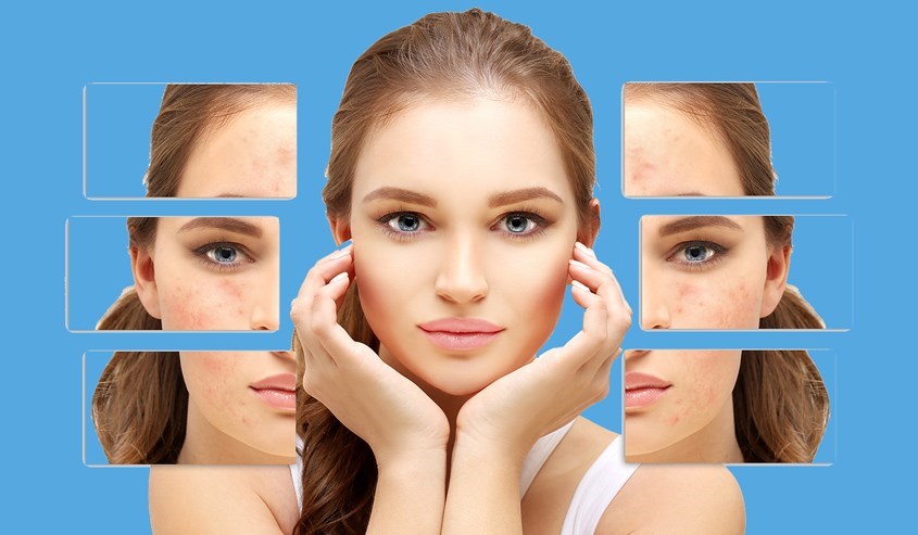 Tinh bột nghệ đỏ và sức khỏe làn da Tinh bột nghệ đỏ và sức khỏe làn da