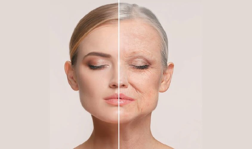 Nghệ có thể hỗ trợ cải thiện và hạn chế nếp nhăn