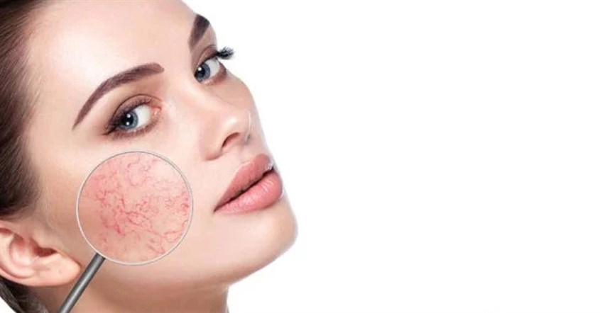 Nguyên nhân dẫn đến tình trạng da nhạy cảm