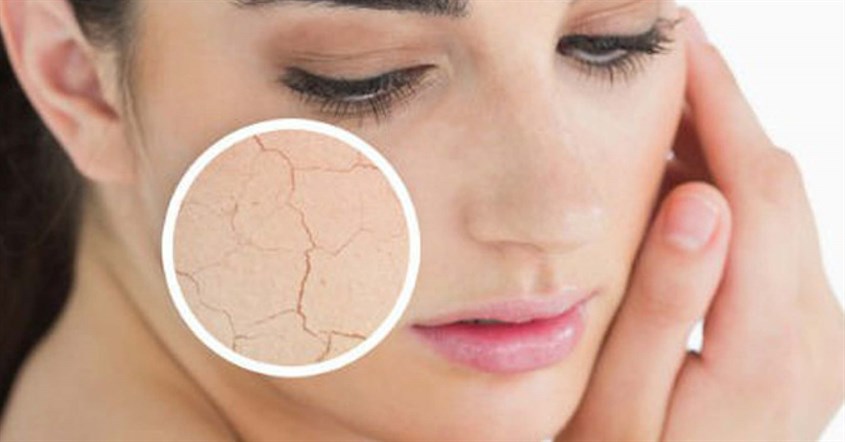 Nguyên nhân dẫn đến tình trạng da khô