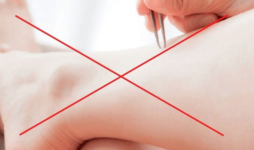 Một số lưu ý khi sử dụng máy triệt lông Homedics