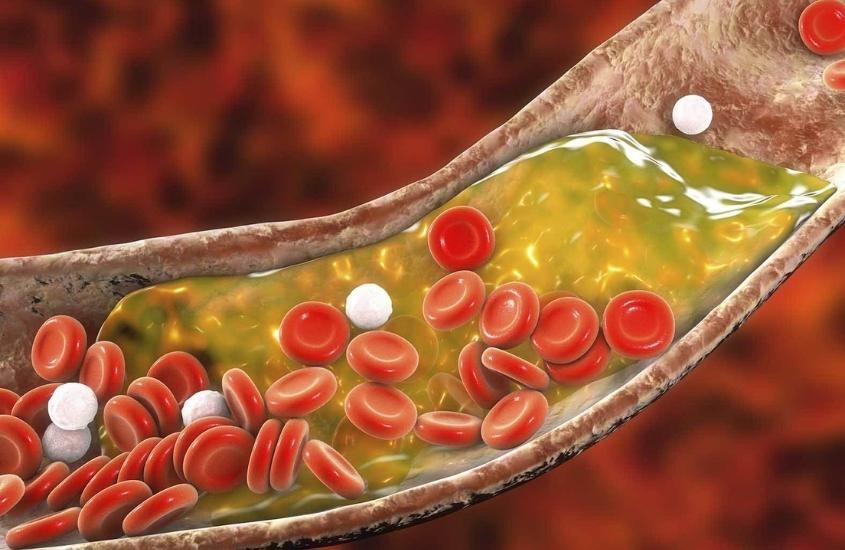 Dầu mè có khả năng hạ mức cholesterol trong máu