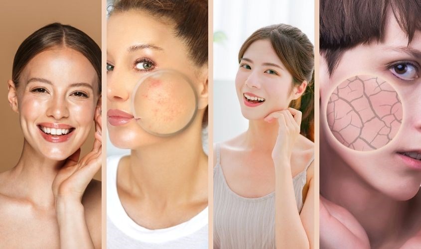 Sữa rửa mặt Senka Perfect Whip phù hợp với mọi làn da