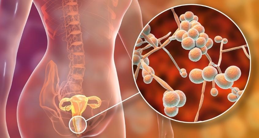 Mặc quần lót quá lâu không thay, tăng nguy cơ nhiễm khuẩn