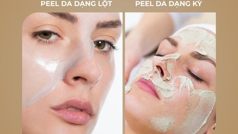 Peel da không chỉ có tác dụng trị mụn mà còn giúp làn da mịn màng và sáng khỏe hơn