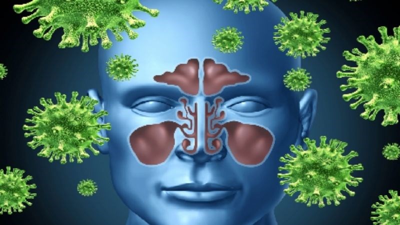 Đa số nguyên nhân gây viêm xoang là do virus