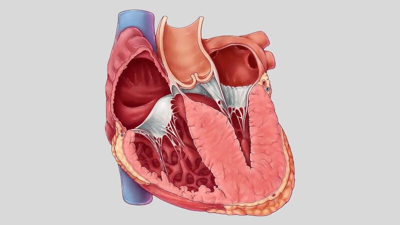 Hình ảnh thất trái dày lên trong bệnh cơ tim phì đại