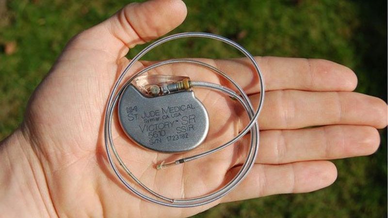 Máy khử rung tim (ICD) giúp điều trị rối loạn nhịp tim