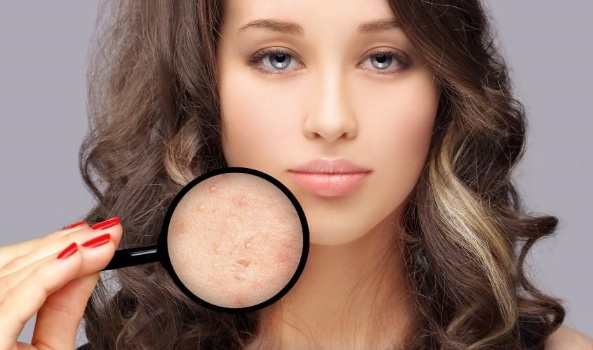 Dầu mù u giúp chữa lành vết thương ngoài da