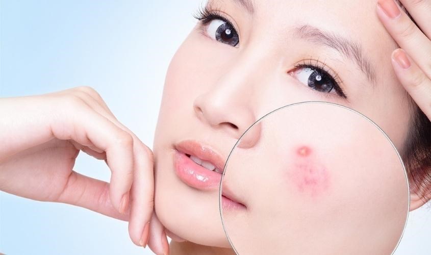 Dầu mù u tái tạo da non, năng ngừa oxy hóa