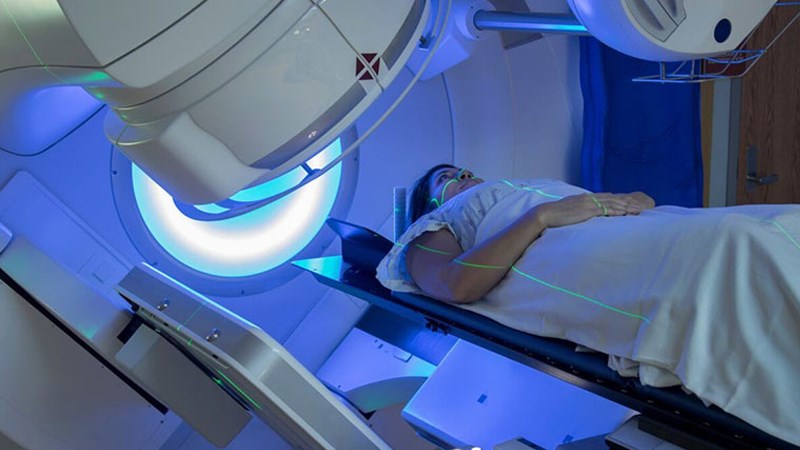 Xạ trị trong điều trị ung thư dạ dày