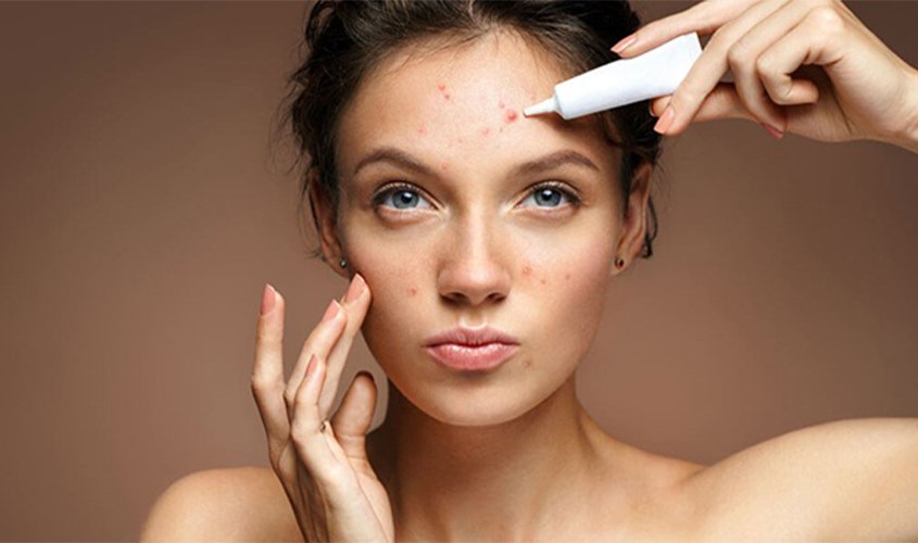 Dầu mù u không làm giảm hiệu quả của các hoạt chất trị mụn khác