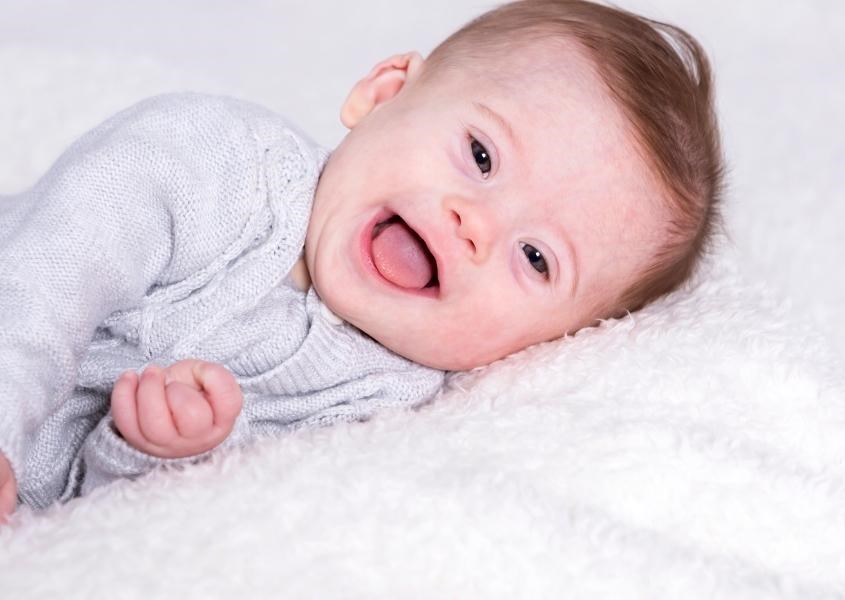 Trẻ mắc hội chứng Down cũng có nhiều nguy cơ bị sặc sữa khi bú mẹ. Nguồn từ NCT Trẻ mắc hội chứng Down cũng có nhiều nguy cơ bị sặc sữa khi bú mẹ. Nguồn từ NCT