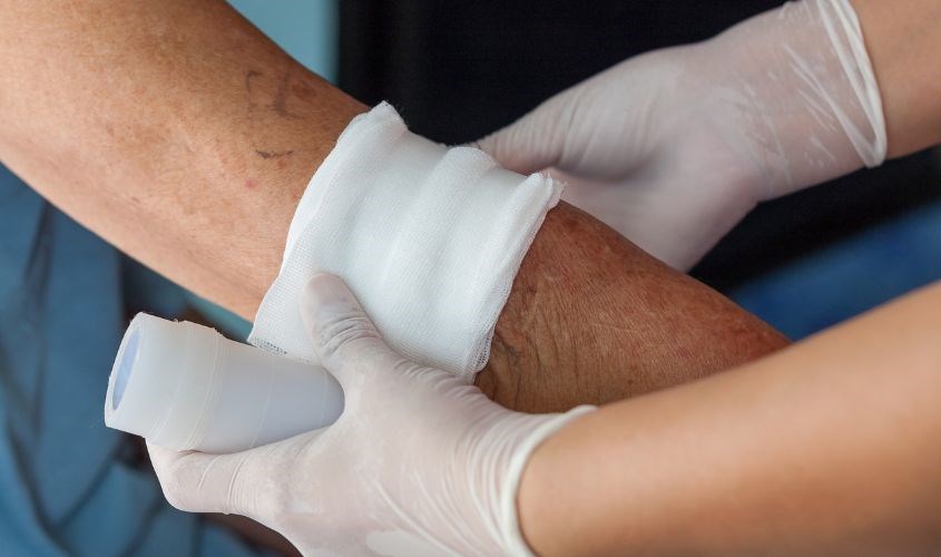 Đối với vết thương hở có nhiều dịch mủ và diện tích lớn thì bạn nên đến cơ sở y tế gần nhất để được điều trị thích hợp