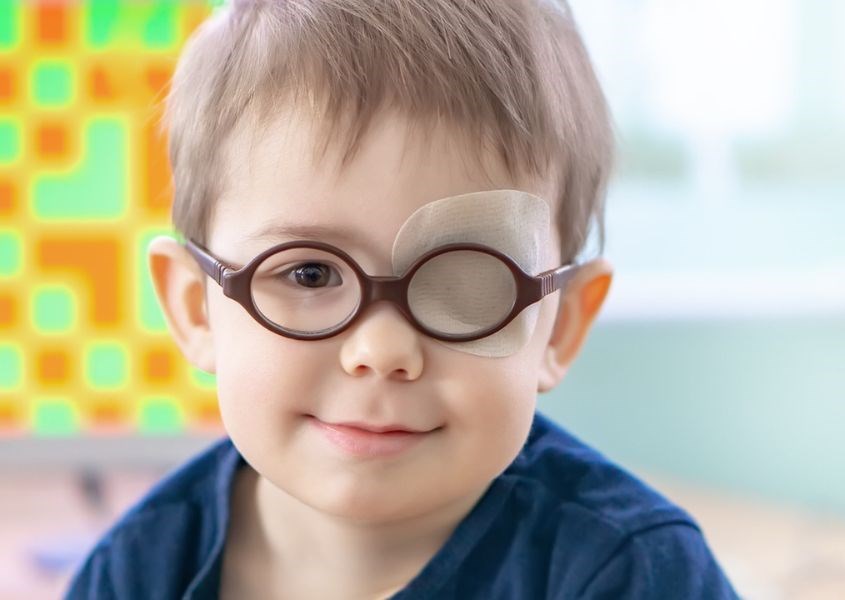 Cha mẹ có thể cho trẻ sử dụng tấm che mắt ở bên mắt bình thường để buộc não sử dụng bên mắt bị lệch. Nguồn từ myvision.org