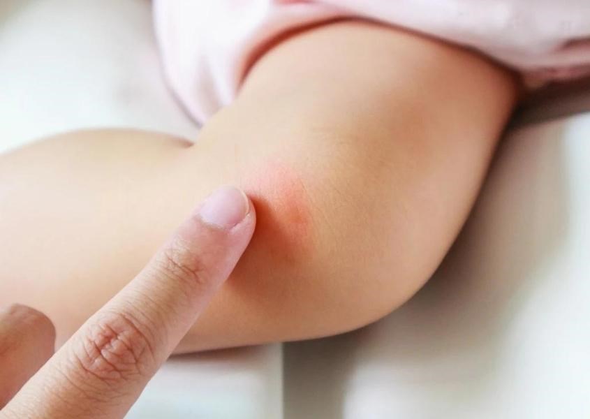 cách đuổi muỗi hiệu quả
