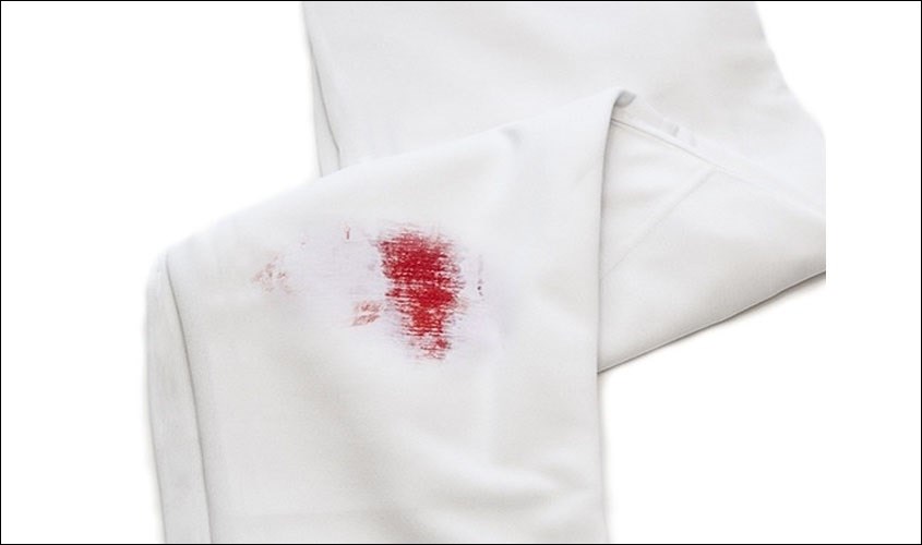 Vết máu trên quần áo luôn là nỗi lo lớn khi bạn vô tình để rơi đúng không? Bạn lo lắng không biết cách tẩy sạch thật đơn giản và hiệu quả? Hãy xem hình ảnh liên quan đến từ khóa \