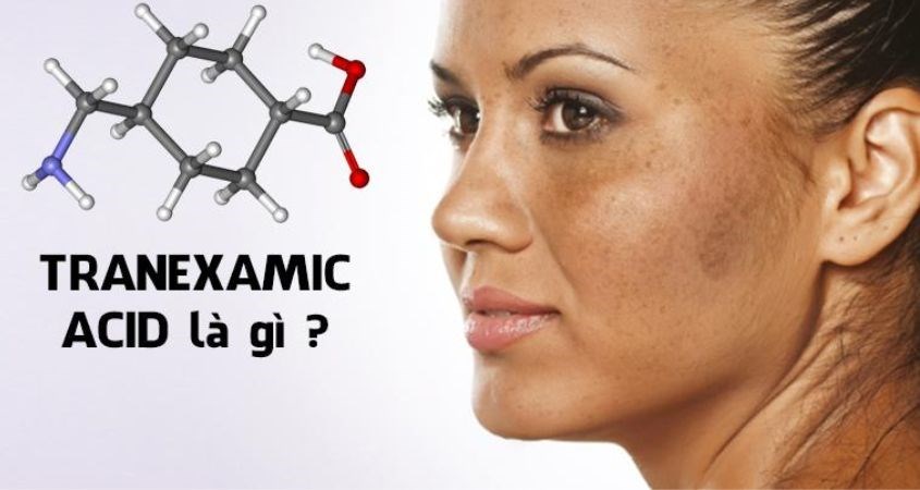 Tranexamic Acid là một dẫn xuất của Lysine