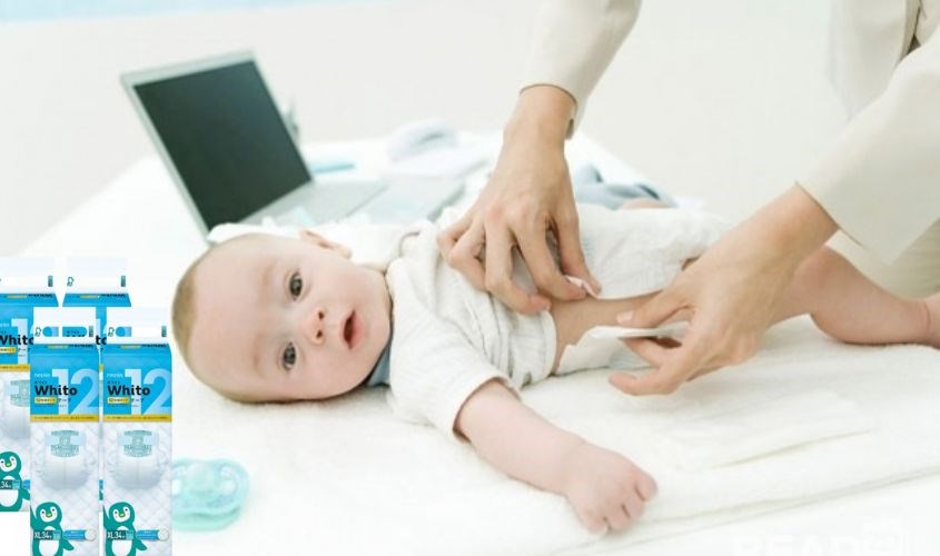 Lưu ý thay tã cho bé thường xuyên mẹ nhé