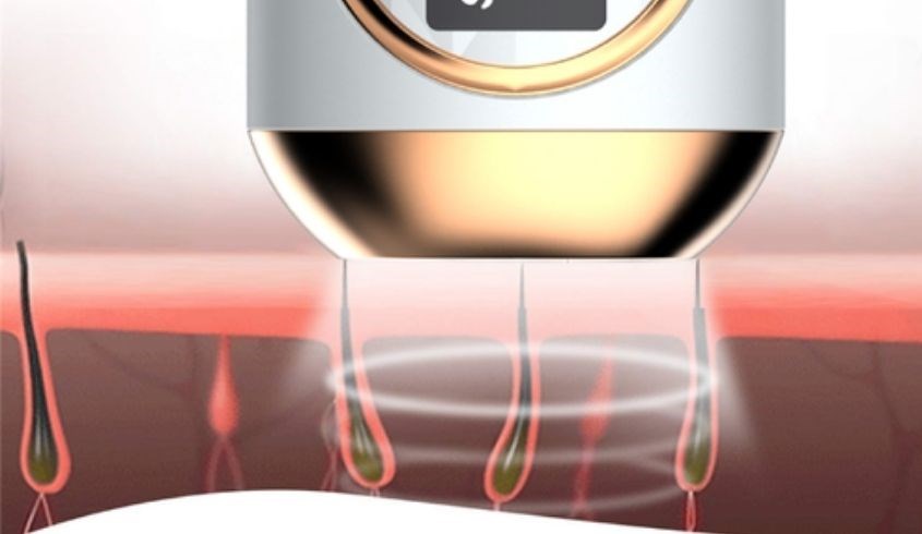 Công nghệ ánh sáng IPL Công nghệ ánh sáng IPL