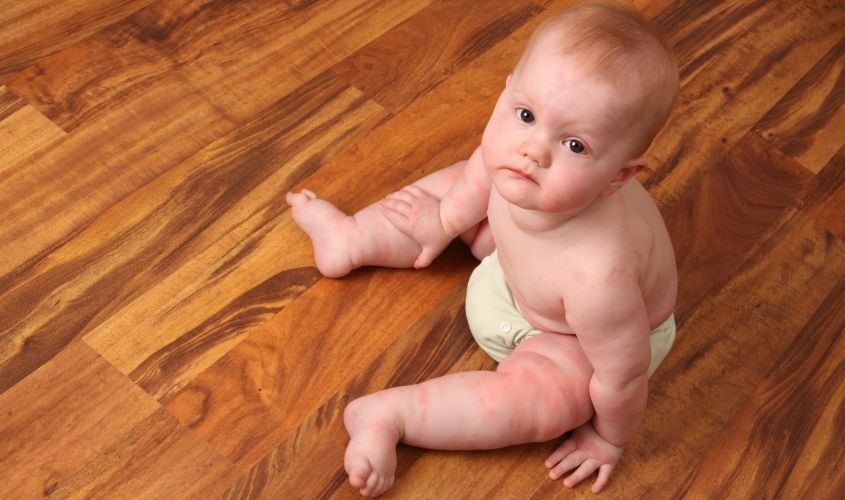 Tã hết hạn sử dụng sẽ mất khả năng hút ẩm làm bé khó chịu