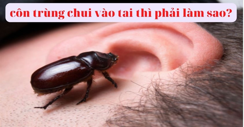Côn trùng chui vào tai thì cần làm gì để xử lý? Nguồn hình istock 