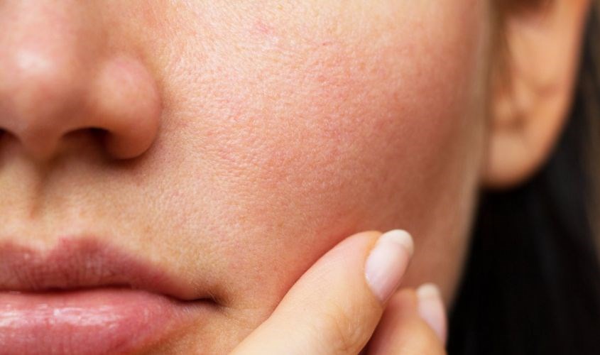 Không gây bít tắt lỗ chân lông