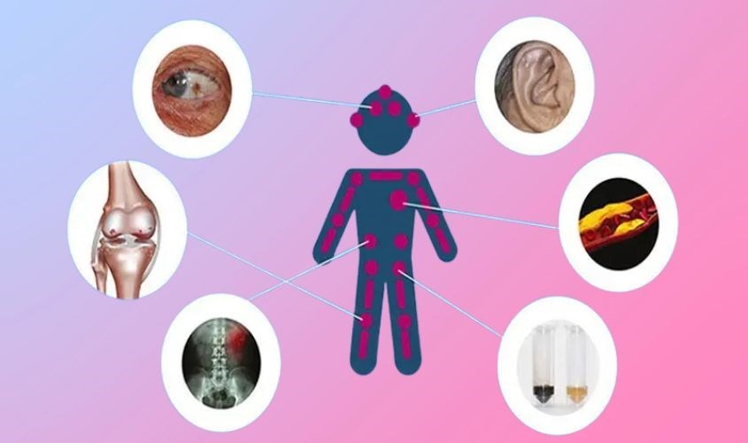 Thiếu hụt tyrosine có thể gây ra nhiều bệnh nghiêm trọng