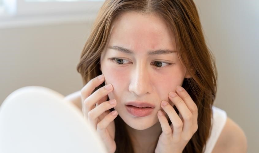 Cách chăm sóc da nhạy cảm bằng sữa ong chúa