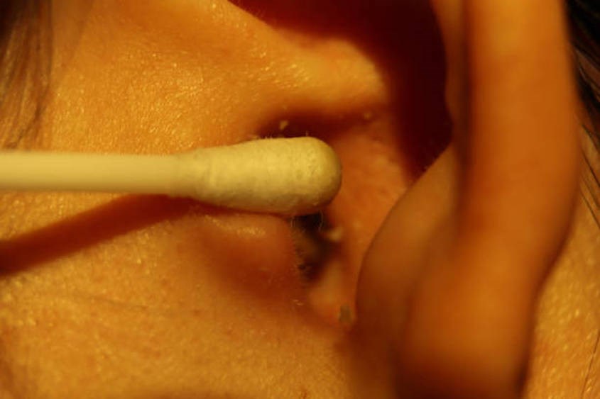 Ráy tai nằm giữa dái tai và màng nhĩ của tai giữa - Nguồn: istockphoto