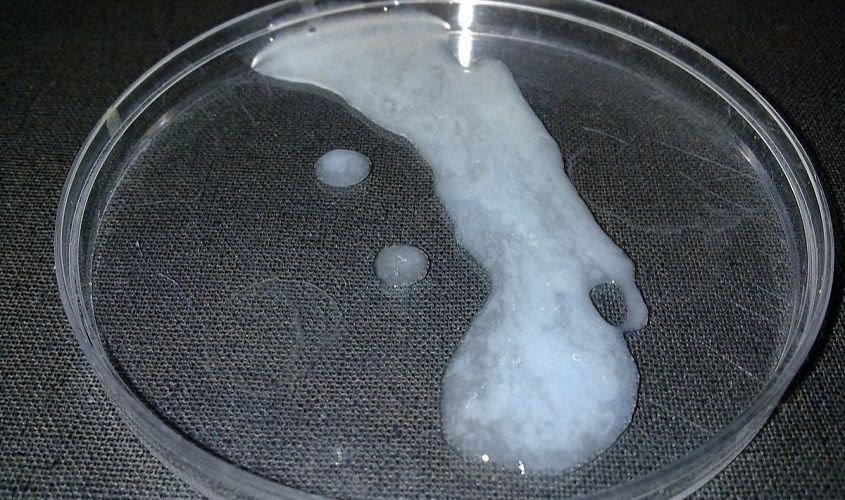 Sữa vón cục là hiện tượng khi mẹ cho trẻ bú bị ọc sữa kèm theo dịch tiêu hóa ở dạ dày