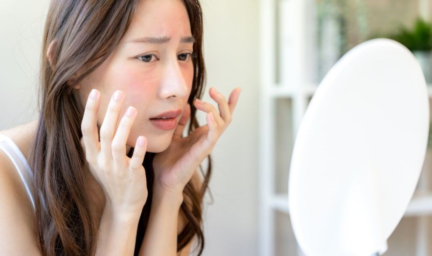 Da nhạy cảm có màng lipit yếu nên dễ bị kích ứng