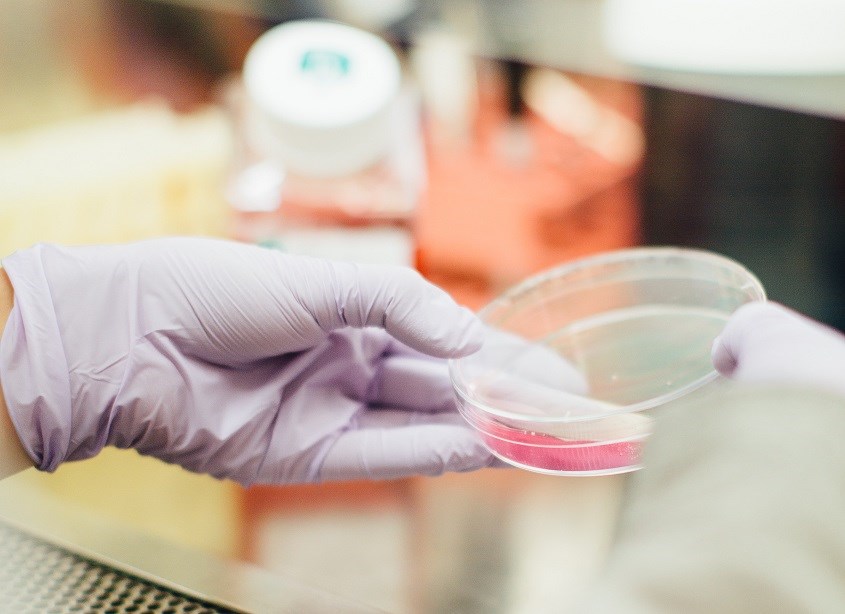 Xét nghiệm sàng lọc sơ sinh giúp phát hiện sớm dị tật bẩm sinh ở trẻ