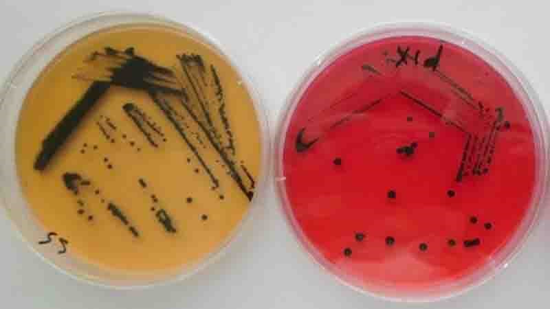 Khuẩn lạc Salmonella điển hình trên thạch Salmonella-Shigella và thạch Xylose-Lysine-Deoxycholate