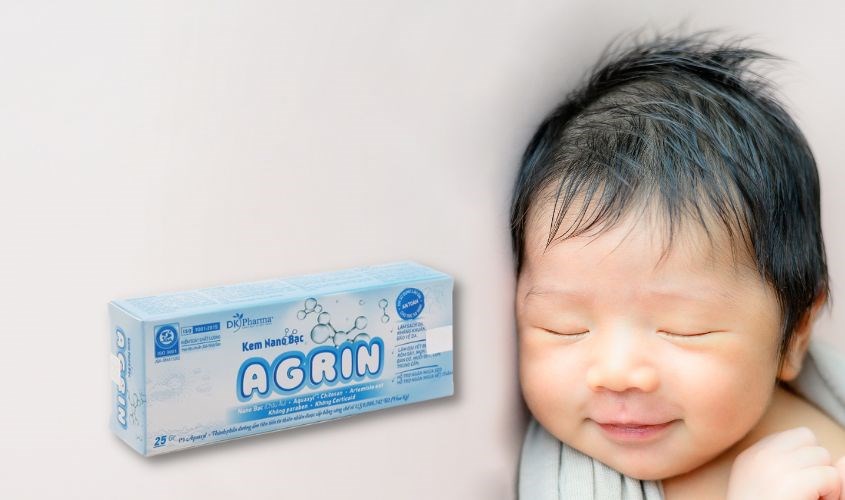 Kem bôi da cho bé Agrin 25g