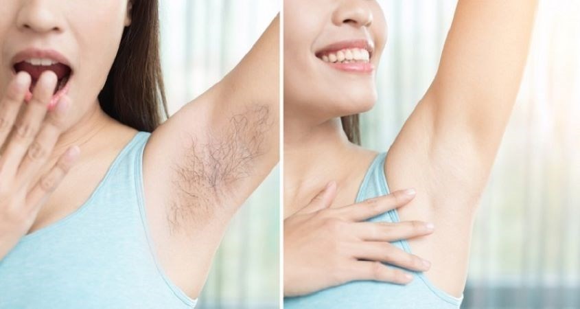 Công nghệ IPL phổ quang ánh sáng rộng hơn giúp triệt sạch lông hiệu quả