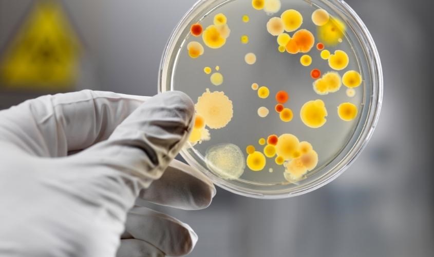 Khăn giấy vệ sinh có hàm lượng vi khuẩn rất cao