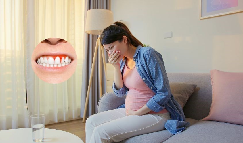 Vitamin C giúp ngăn ngừa chảy máu lợi Vitamin C giúp ngăn ngừa chảy máu lợi