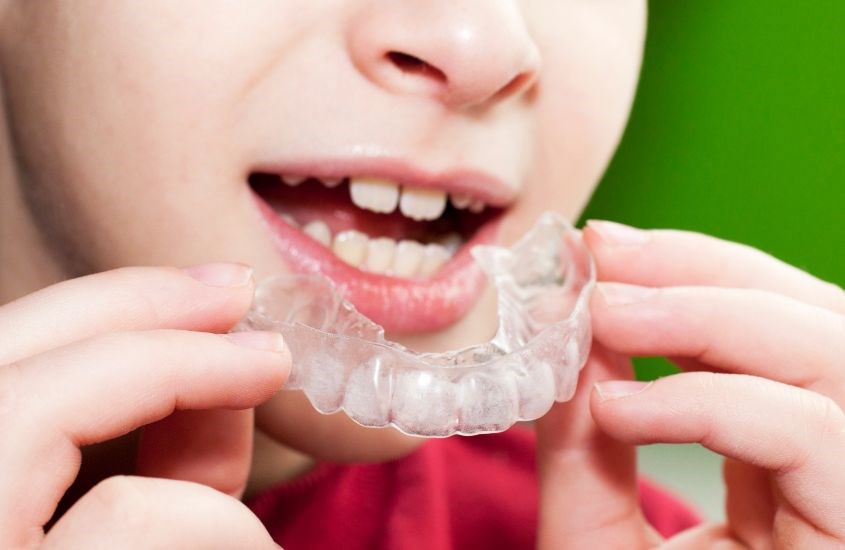 Máng bảo vệ răng giúp giảm áp lực lên răng